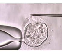Вспомогательный хэтчинг эмбрионов